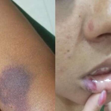 Jovem diz ter escapado do que poderia ser 3º feminicídio em 1 semana em MS