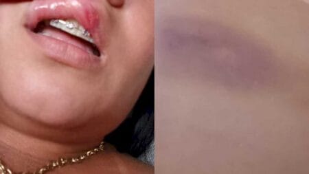 ‘Estou machucada por dentro e por fora’: diz mulher que fugiu do namorado