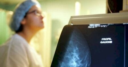 Por que a mamografia é tão vital contra o câncer de mama?