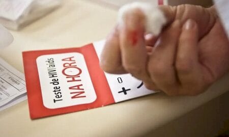 Aids: Brasil tem alta de casos, mas menor mortalidade desde 2013 BATANEWS/AGêNCIA BRASIL