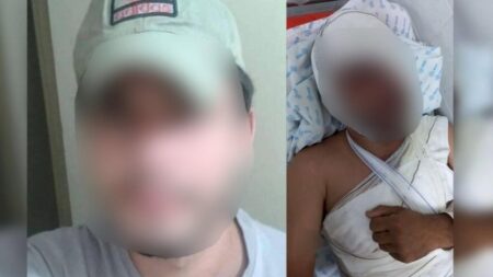 Mulher que jogou água fervente em rosto de namorado que perdeu a visão é presa pela polícia