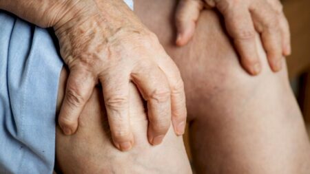 Silenciosa, lipedema é doença que desafia diagnóstico e impacta autoestima