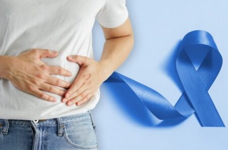 Especialista alerta para câncer de intestino: rastreamento deve começar aos 45 anos