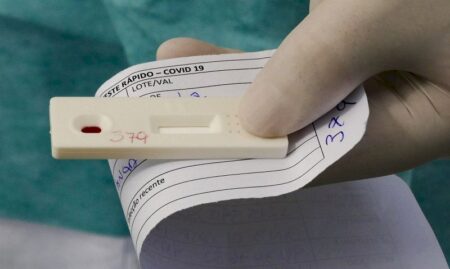 MS registra 20 mortes por Covid-19 em 2025, queda de 41% em relação ao ano anterior
