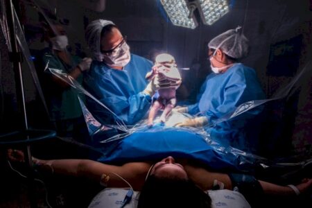 Quando a cesárea é realmente necessária, segundo a ciência | Letra de Médico
