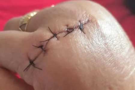 Professora é atacada com faca por aluna de 14 anos durante aula: ‘Vou te matar’