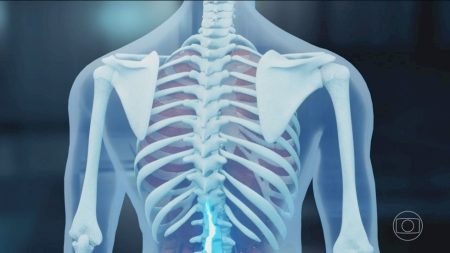 Polilaminina: o que se sabe sobre proteína que pode recuperar movimentos