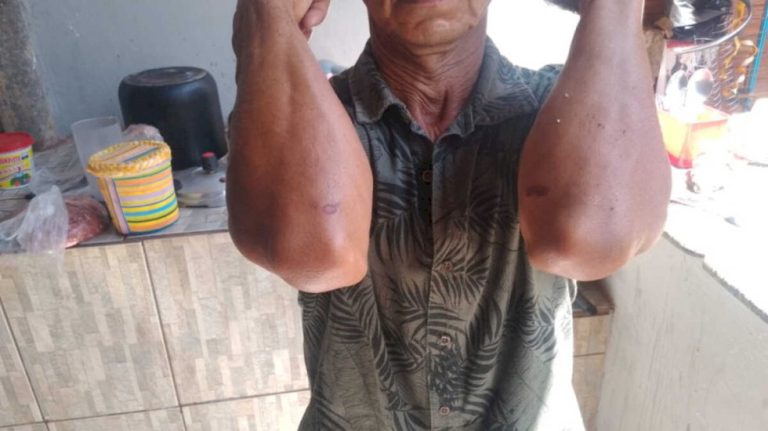 Idosa é vítima de importunação, pede ajuda e acaba arrastada pelo cabelo por funcionário em baile