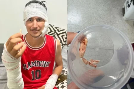 Peão guarda como amuleto garra de onça que ficou cravada em perna durante ataque no Pantanal.