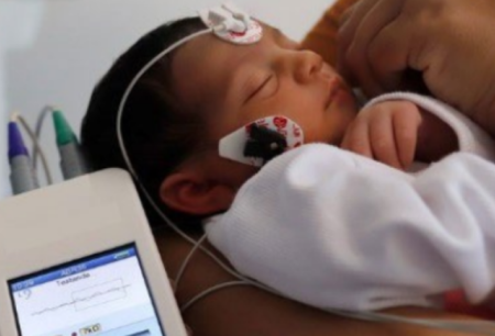 Ministério da Saúde lança novo Guia Nacional da Triagem Auditiva Neonatal