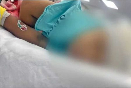 RJ: bebê é baleada na cabeça após família ser abordada por traficantes