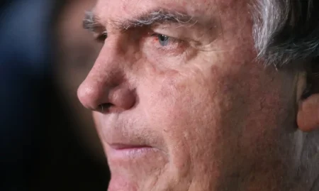 Com crise persistente de soluços, Bolsonaro faz nova cirurgia.