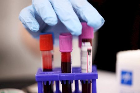 Sem respaldo, exames de sangue para detectar câncer precoce ganham espaço nos EUA