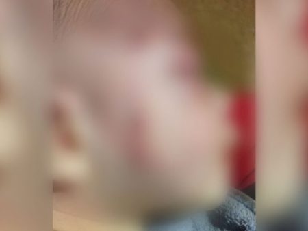 Bebê espancado pelo próprio pai está fora de risco em Campo Grande