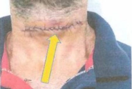 Homem que invadiu casa e tentou matar rival a facada é condenado a mais de 12 anos