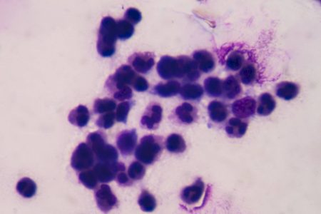 Como a bioeletricidade pode abrir novas vias contra o câncer