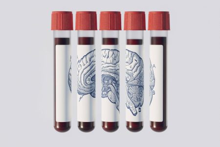 Exame de sangue promete prever Alzheimer anos antes; entenda por que médicos pedem cautela