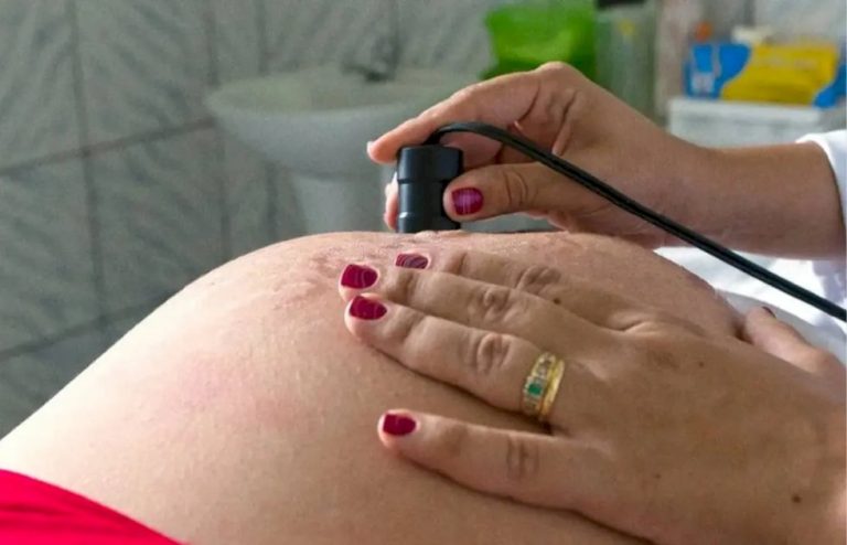 Parto normal é preferência de 70% das brasileiras no início da gravidez; campanha reforça autonomia e informação para gestantes
