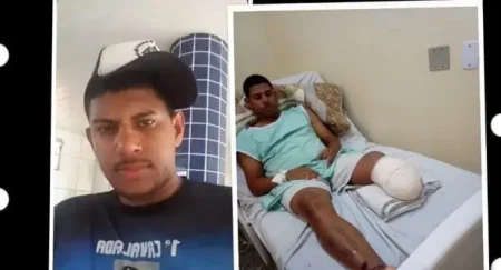 Após perder parte da perna em acidente, morador de Nova Casa Verde faz campanha para comprar nova prótese