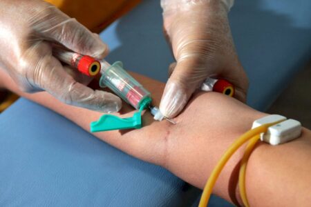 Exame de sangue ajuda a identificar 4 vezes mais casos de câncer