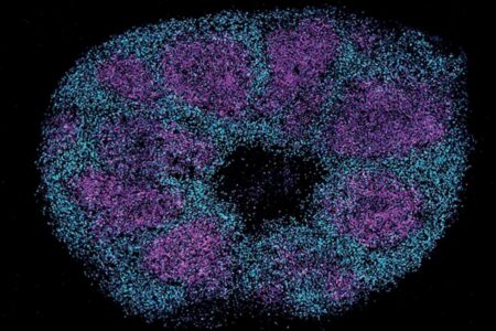 Estudo de proteínas cerebrais traz otimismo sobre tratamento para autismo
