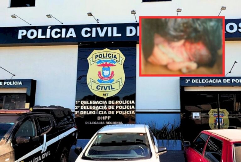 Inquérito sobre bebê encontrada morta em lixeira em VG pode levar até 3 meses para ser concluído