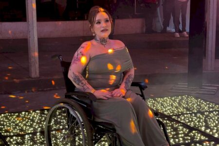 ‘Não preciso que a dor vá embora, só que me deixe viver’, diz brasileira com a pior dor do mundo