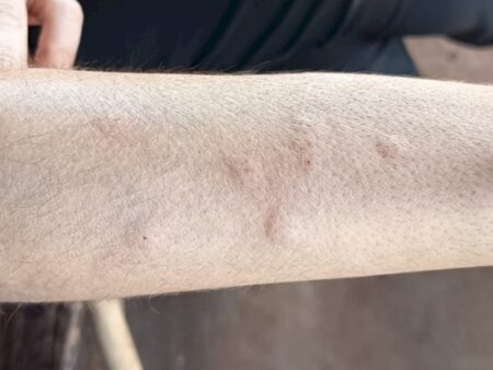 MPMS investiga possível relação entre usina de açúcar e álcool e infestação de moscas em Angélica